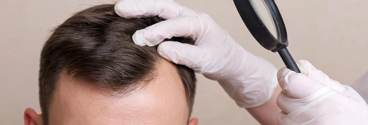 Saç Ekimi Süreci: Konsültasyondan Nihai Sonuca Adım Adım Zaman Çizelgesi