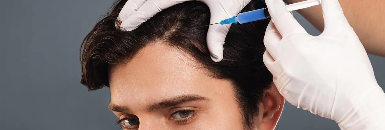 PRP Destekli Saç Ekimi: Kimlere Uygun, Nasıl Yapılır