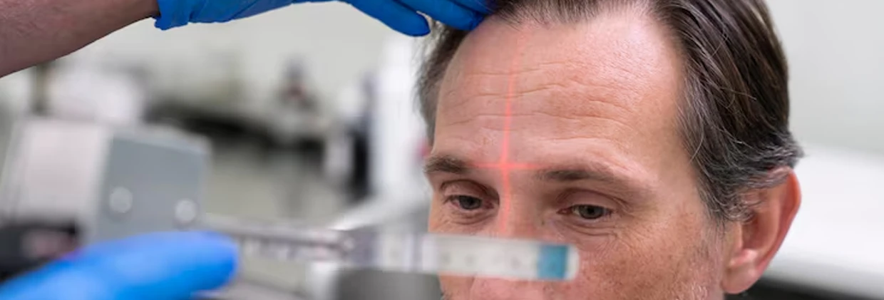 PRP Saç Ekimi + FUE Saç Ekimi Bir Arada: Kombinasyonun Avantajları