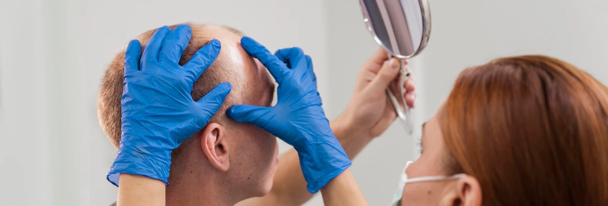 Saç Ekimi Çözümlerinin Ömrü: Ne Kadar Süre Kalıcı Olur?